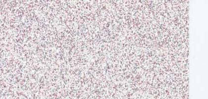 Speckles